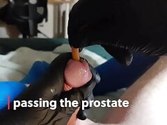 Bladder torture