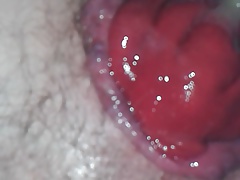 after fisting ass