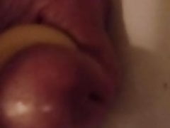 Gummifotze