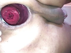 Pussy wide gaped & prolasped Aug-16-2018