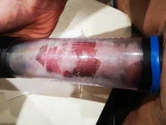 Pump Beefstick for 1h Opened Up Foreskin