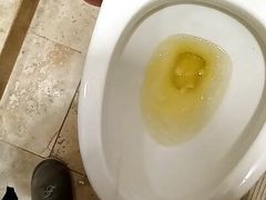 Uncut Village Cock Pissing #13