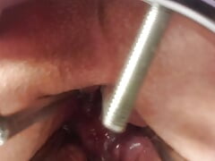 Opening my ass up with my expander toy