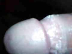 ripe smegma dick my friend  - dmitr1971