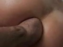 Fisting Arsch